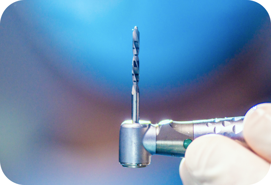 Dental implant placement in Geneva | Drs. Arnaud, Hugentobler & Oeggerli | Geneva