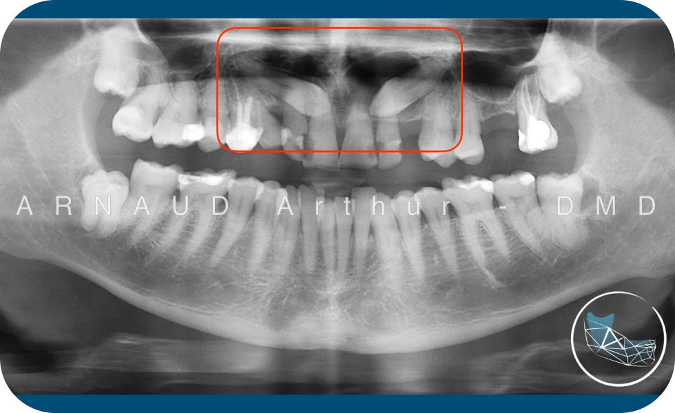 Dr. Arthur Arnaud | Spécialiste en Chirurgie orale | Genève-Morges