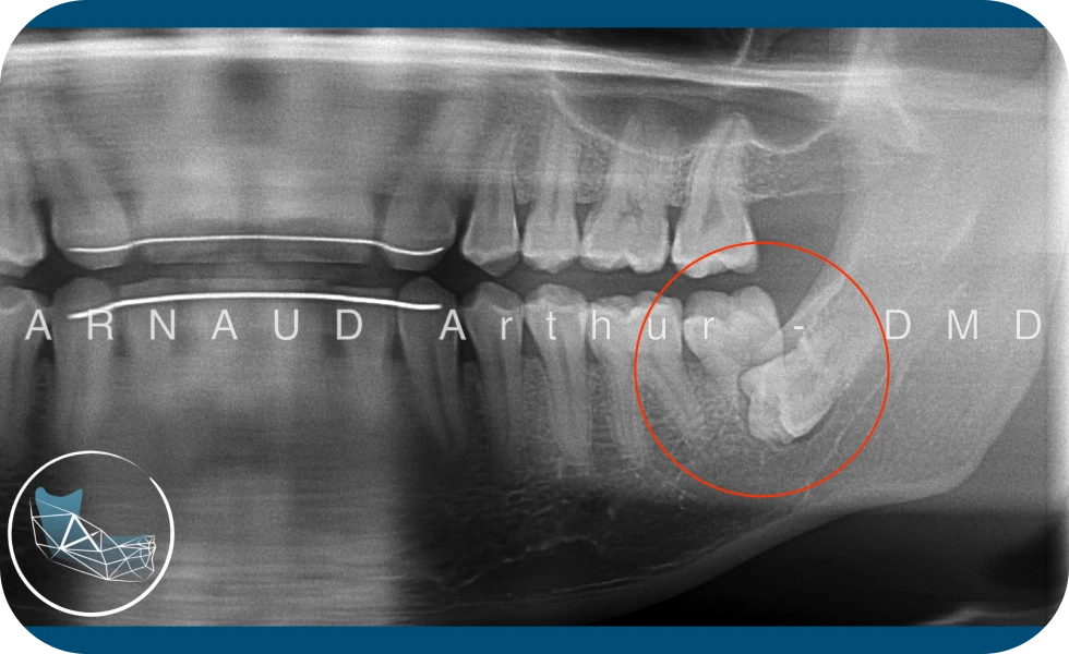Dr. Arthur Arnaud, spécialiste en Chirurgie orale à Genève et à Morges