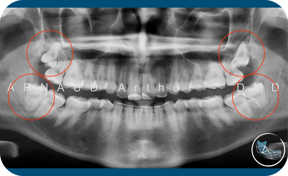 Dr. Arthur Arnaud, spécialiste en Chirurgie orale à Genève et Morges