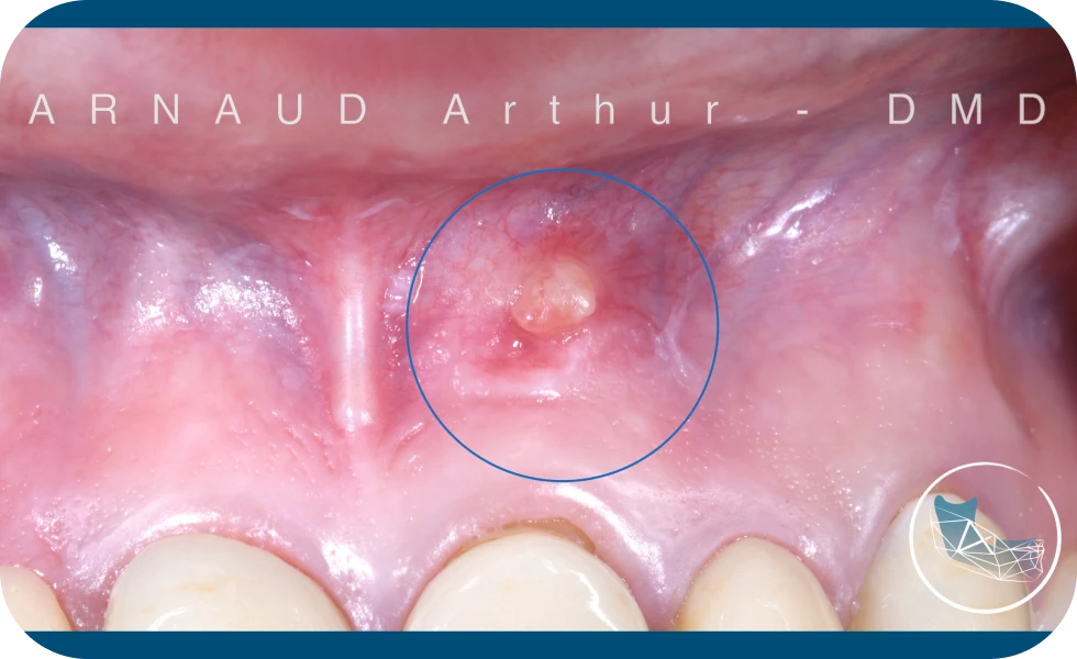 Centre de Chirurgie orale et Maxillo-faciale à Genève / Drs Arnaud, Hugentobler & Oeggerli