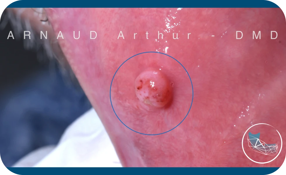 Centre de Chirurgie orale et Maxillo-faciale à Genève / Drs Arnaud, Hugentobler & Oeggerli