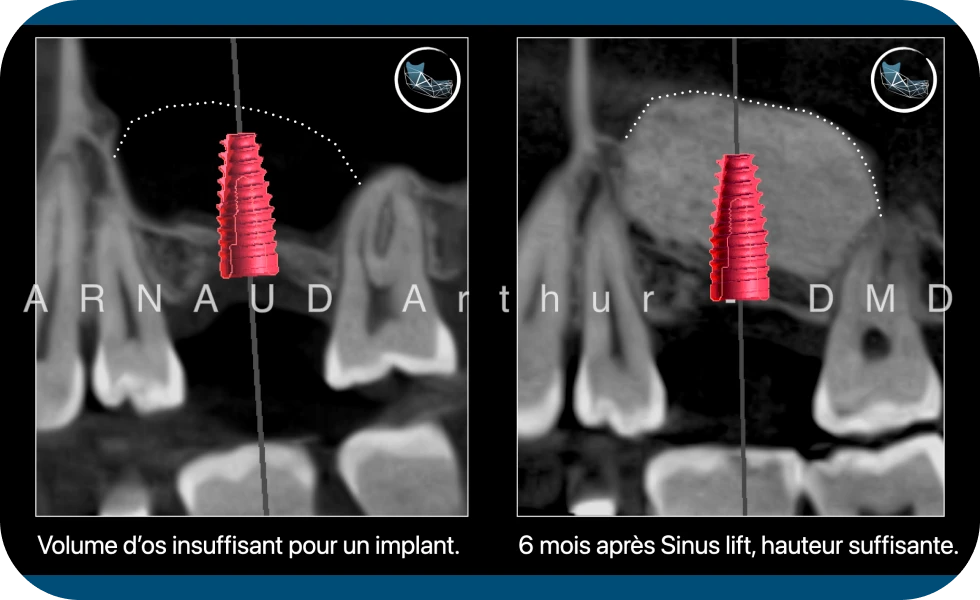 Dr. Arthur Arnaud | Spécialiste en Chirurgie orale | Genève-Morges