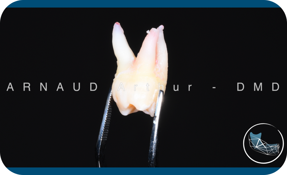 dents sagesse extraction docteur arnaud geneve Dents de sagesse Drs. Arnaud, Hugentobler & Oeggerli | Oral Surgery | Geneva